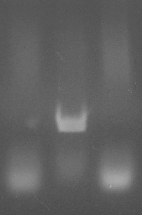 antibiótico kanamicina, porque quando o plasmídeo pet 28a(+) consegue infectar a bactéria, ele induz resistência a esse antibiótico.