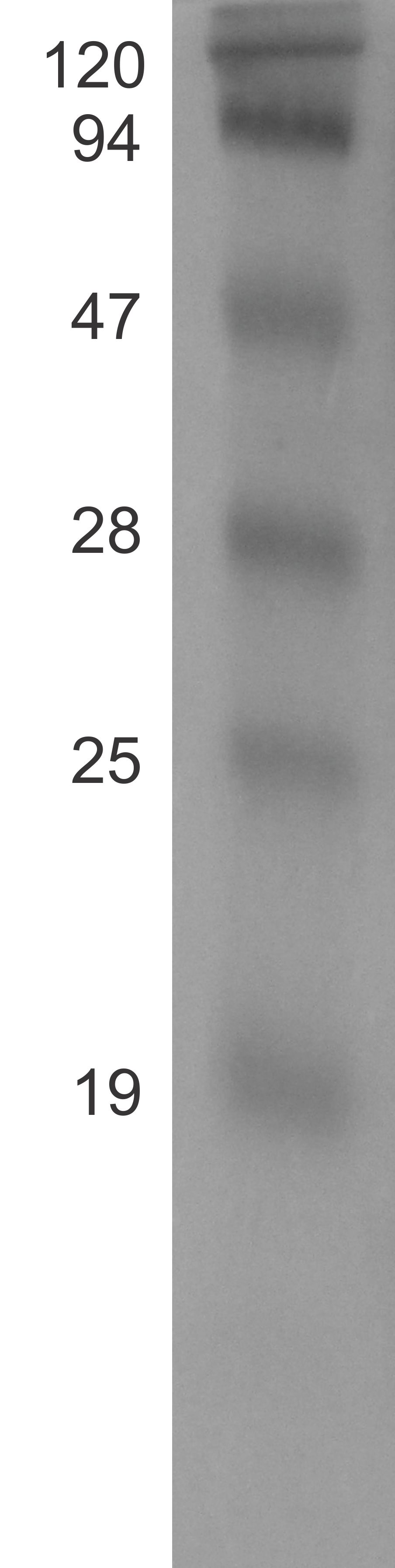 kda PM 01 02 03 04 05 Figura 5: A imagem mostra o gel de poliacrilamida depois da eletroforese. A amostra 01 foi retirada do meio com a bactéria BL21 inicialmente.