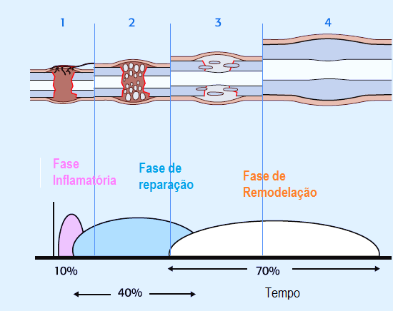 Intensidade de resposta Revisão Bibliográfica movimento intrafragmentário local (Kraus, 2003), isto é, o calo aumenta com a instabilidade (Griffon, 2005).