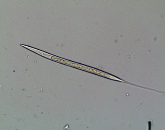 2.6.2. Ciclo biológico Os parasitas que constituem a família Strongylidae têm um ciclo biológico monoxeno com duas fases, a exógena e a endógena