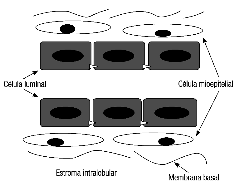 27 Figura 7. Histologia esquemática do Epitélio Mamário Fonte: Baseado em Fernandes, 2009 (31) A maior parte das neoplasias da mama é derivada das unidades terminais ducto-lobulares das mamas.