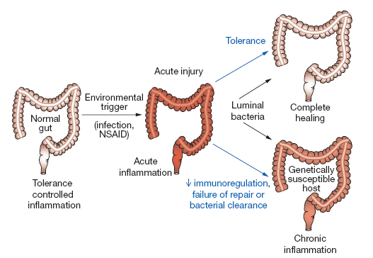 Figura. 2 Diferentes respostas à lesão intestinal.