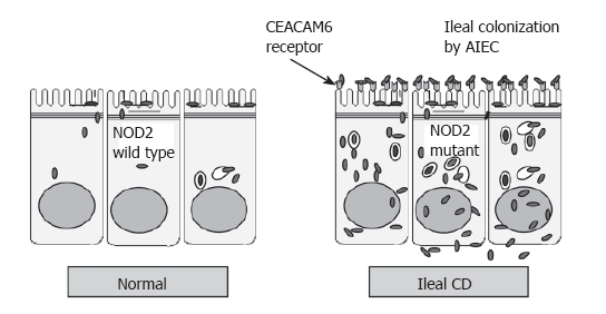 Figura 20 Comparação na expressão da CEACAM6 em indivíduos normais e naqueles com DC.