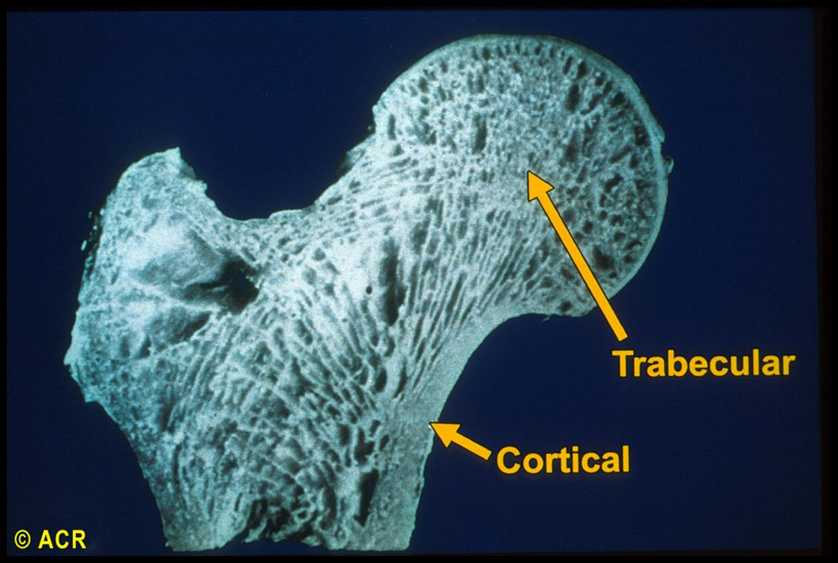 O tecido ósseo é um tipo especializado de tecido conjuntivo constituído por células e material extracelular calcificado, a matriz óssea (osteóide); no esqueleto axial, representa apenas 25% do volume