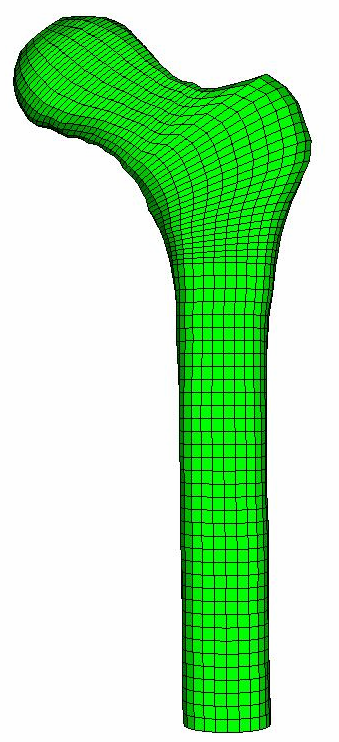 6. Metodologia adoptada Nesta secção são descritos e analisados os passos seguidos na obtenção, cruzamento e comparação dos resultados obtidos pelo modelo computacional de remodelação óssea e pela