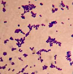 Staphylococcus sp Streptococcus sp Cocos Gram positivos Catalase +