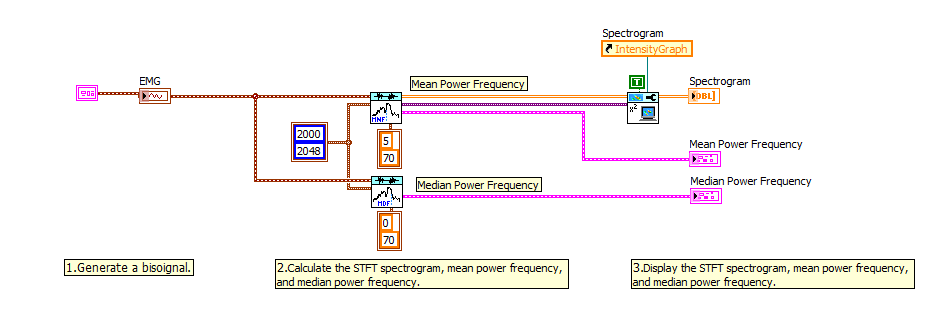 Analisador de espectro EMG 1.