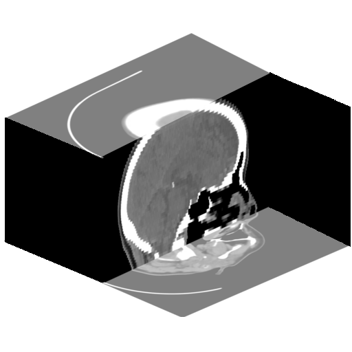 10 Figura 2.1: Voxels constituindo um volume (HADWIGER et al., 2008). (a) Imagens obtidas por CT (b) Corte no volume resultante formado por 50 imagens Figura 2.