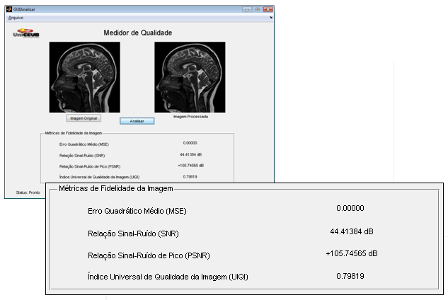 74 Figura 5.1635 Resultados de MSE, SNR, PSNR e UIQI para filtragem inversa de imagem com borrão de movimento.