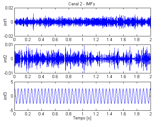 57 O sinal do canal 1 foi gerado com frequência de 10 Hz e é confirmado pelo espectro de frequência da Figura 31.