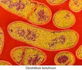 Modo de transmissão Ocorre por ingestão de toxinas presentes em alimentos previamente contaminados, que são produzidos ou conservados de maneira inadequada.