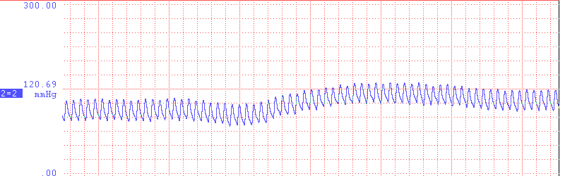 13 HF e da razão LF/HF foram consideradas como marcadores simpático e parassimpático, e do balanço simpato-vagal, respectivamente 31.