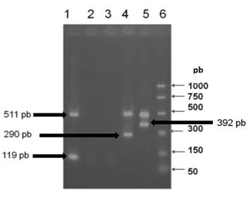 Os fragmentos no gel de agarose a 2% (figura 14) indicam os sorotipos virais: 119 pb (DENV 2), 290 pb (DENV 3) e 392 pb (DENV4). O fragmento de 511 pb é especifico para o gênero Flavivirus.