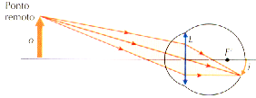Defeitos da Visão Miopia: Alongamento do Globo Ocular. Foco F da Lente não está na Retina,, mas sim ANTES dela.