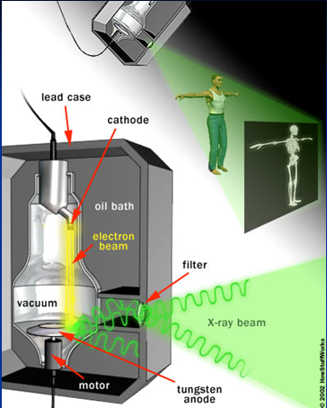 Aparelho de radiografia Móvel Espectro eletromagnético Tradicional Cirúrgico Tecido macio Átomos menores Absorção de raios X Não absorvem bem os fótons Ossos Átomos de cálcio são grandes Absorvem bem