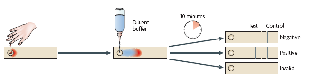 DIAGNÓSTICO leishmaniose visceral rk39 strip test- dipstick (ELISA) K39=kinesin-related protein Sensibilidade e especificidade de 94 e 95%