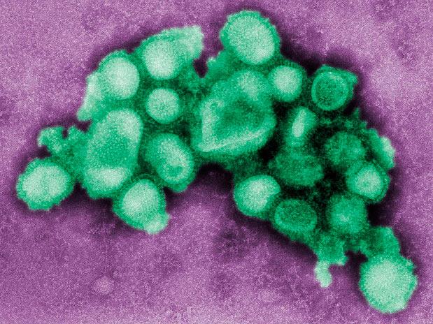 Imagem microscópica do vírus H1N1,