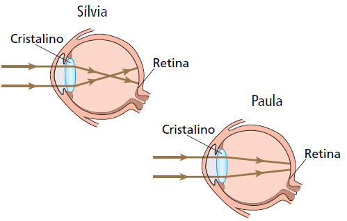 d) divergente, de -3 dioptrias. e) Não é necessário justapor nenhuma lente. 105.