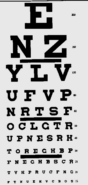 DIPLOPIA NÃO CRUZADA (fig A) É quando o objeto está localizado atrás da Área de Panum e estimula retinas binasais.