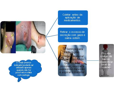 seroso que é adequado para Cultura de Secreção de Orofaringe Figura: Ilustração do material a ser colhido: 1 Stuart de cada local + 1Lâmina de cada local Para este