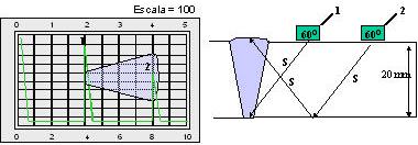 Pulso-eco