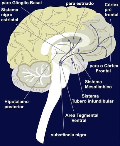 Vias dopaminérgicas SINTOMAS POSITIVOS Hiperfunção na Via