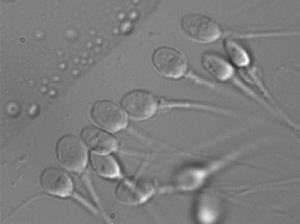 Introdução Qualidade seminal MSOME Motile Sperm Organelle Morphology Examination (MSOME) Introduzida em 2001 Avaliação