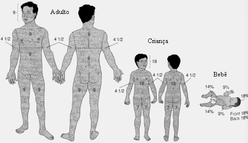 O risco de vida (gravidade do caso) não está no grau da queimadura, mas na extensão da superfície atingida.