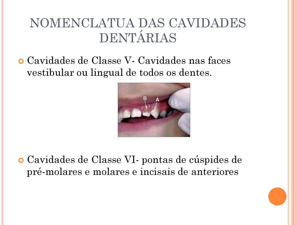 de todos os dentes.