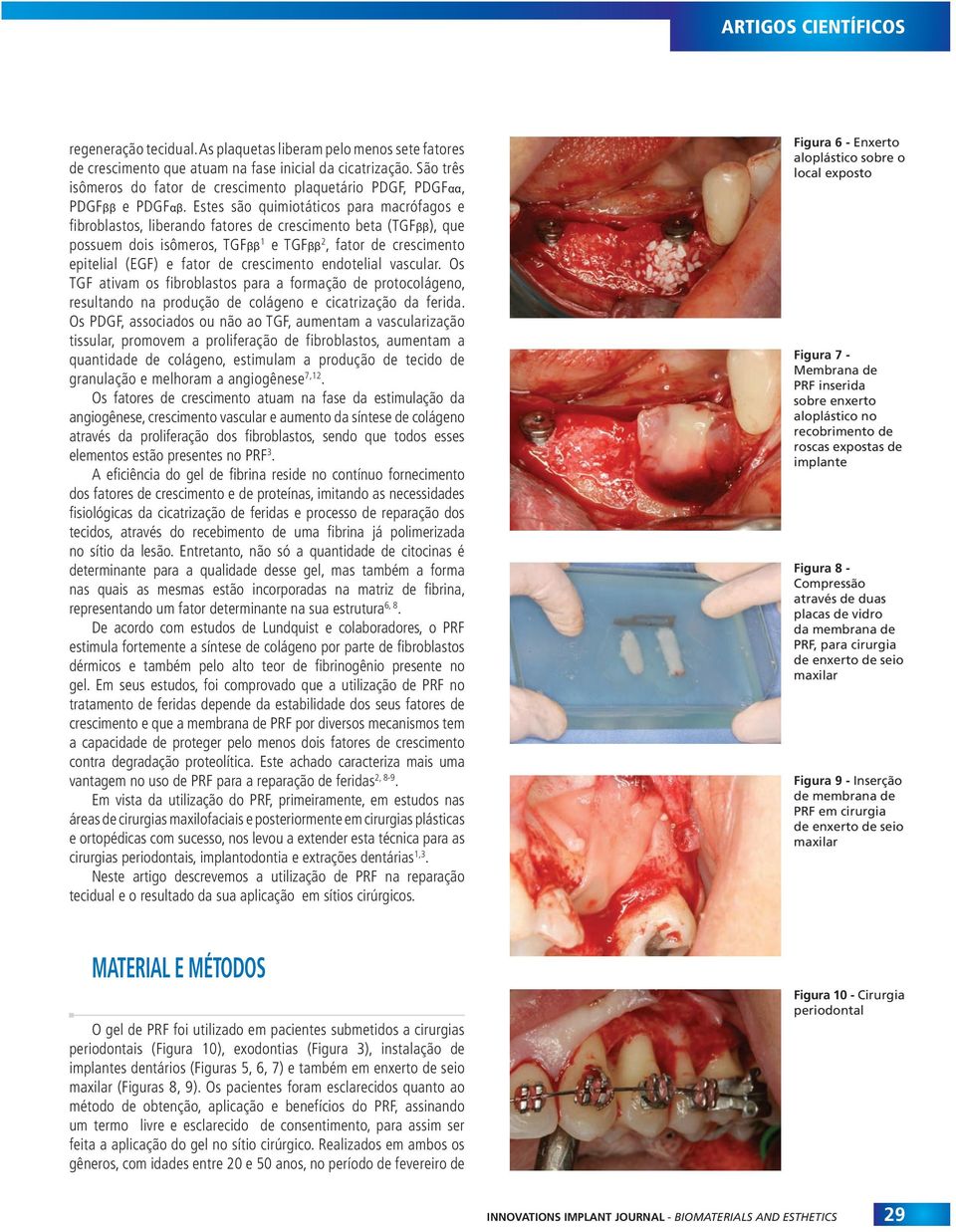 Estes são quimiotáticos para macrófagos e fibroblastos, liberando fatores de crescimento beta (TGFββ), que possuem dois isômeros, TGFββ 1 e TGFββ 2, fator de crescimento epitelial (EGF) e fator de