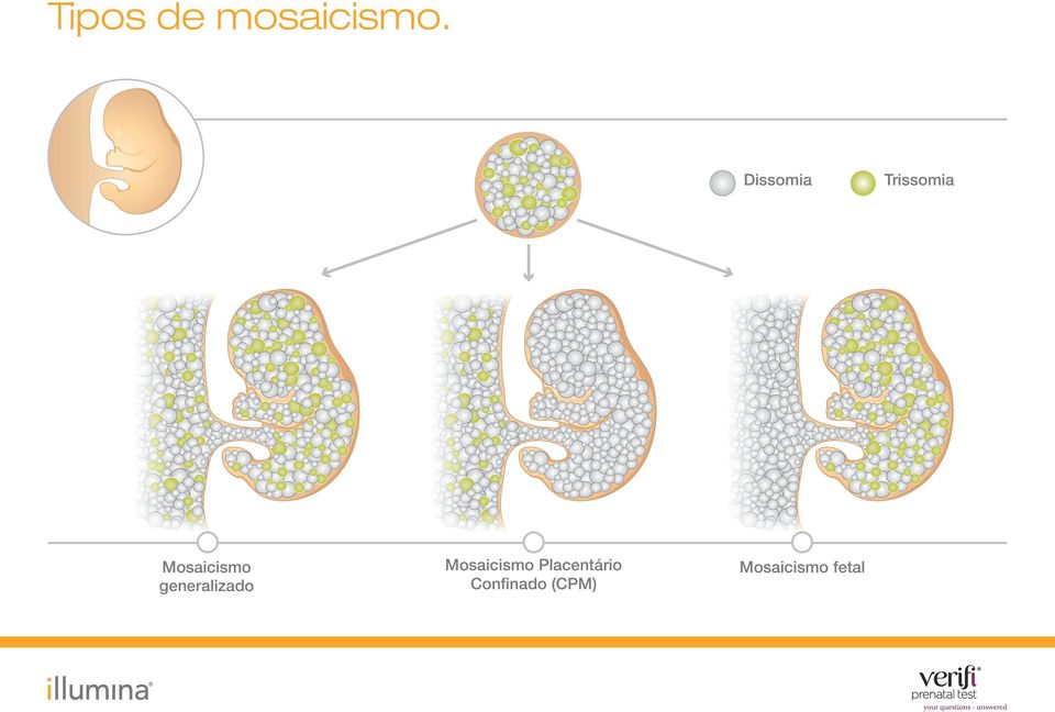 generalizado Mosaicismo