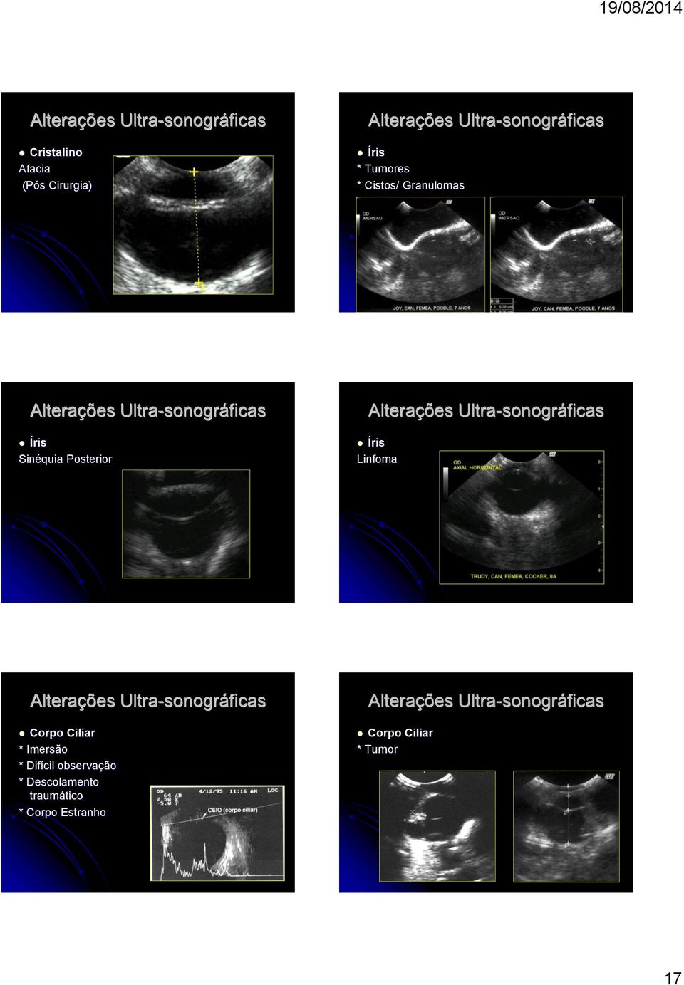 Linfoma Corpo Ciliar * Imersão * Difícil observação *