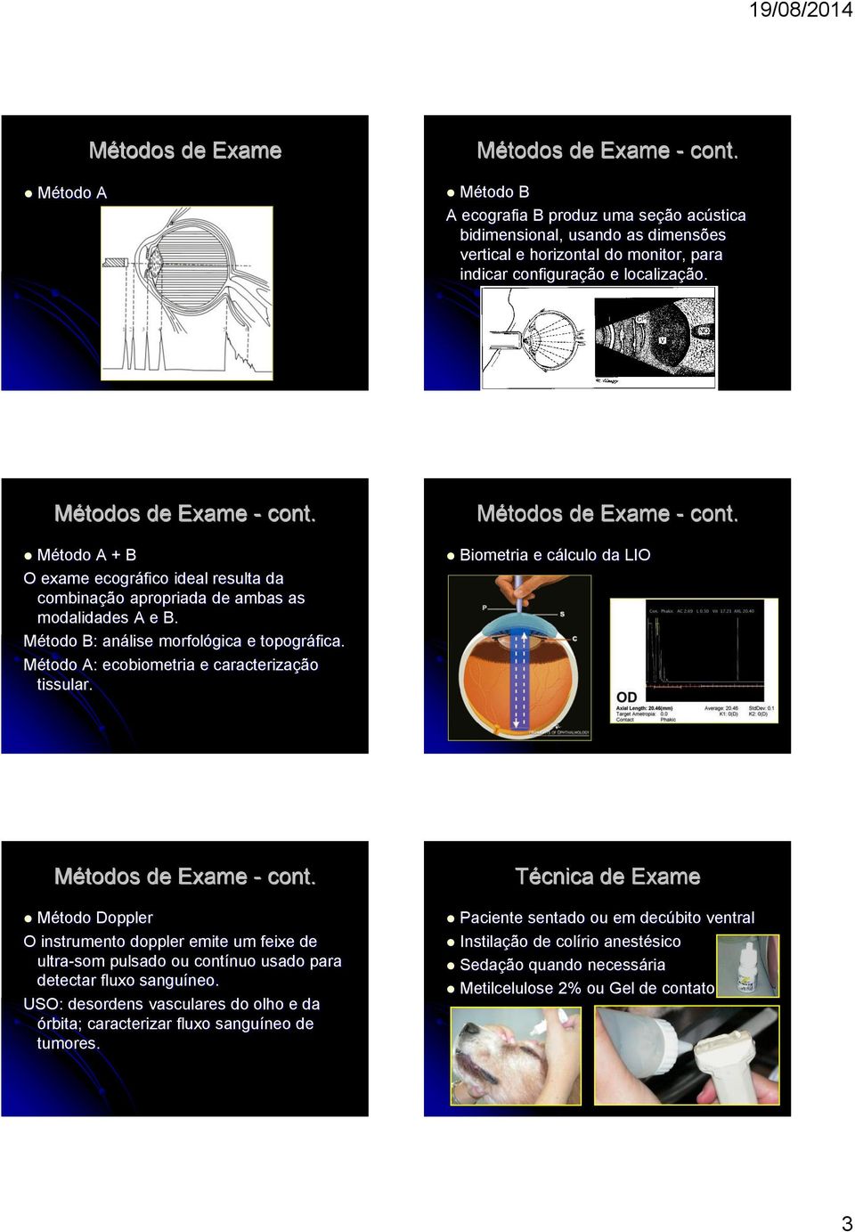 Método A + B O exame ecográfico ideal resulta da combinação apropriada de ambas as modalidades A e B. Método B: análise morfológica e topográfica. Método A: ecobiometria e caracterização tissular.