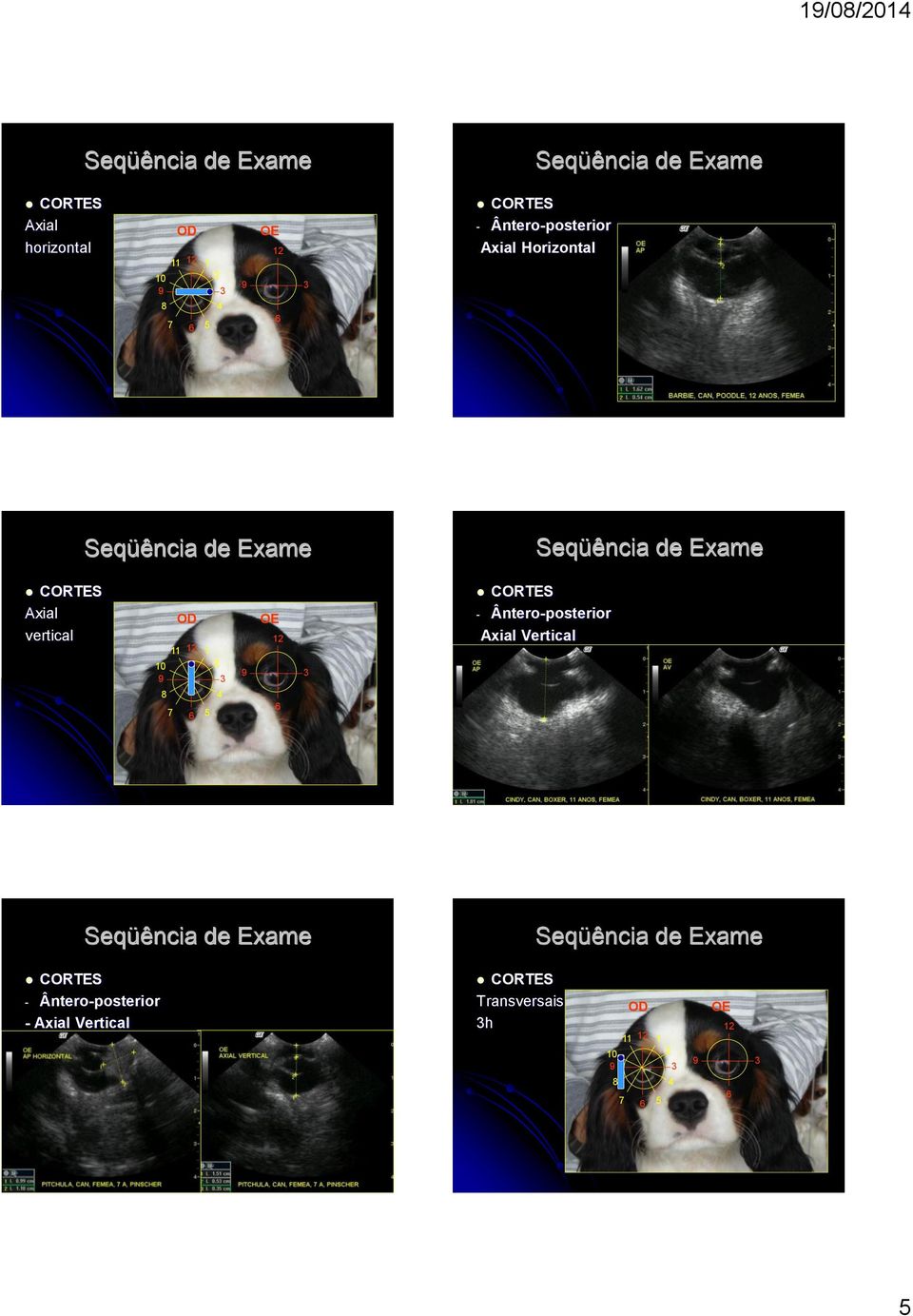 12 10 9 8 7 6 1 2 5 4 3 9 OE 12 6 3 CORTES - Ântero-posterior Axial Vertical Seqüência de Exame Seqüência de