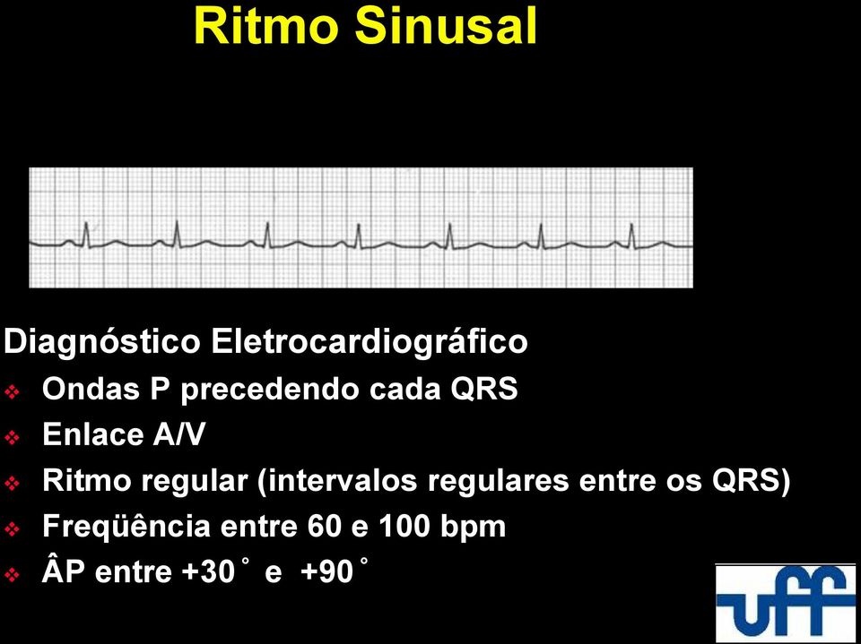 regular (intervalos regulares entre os QRS)