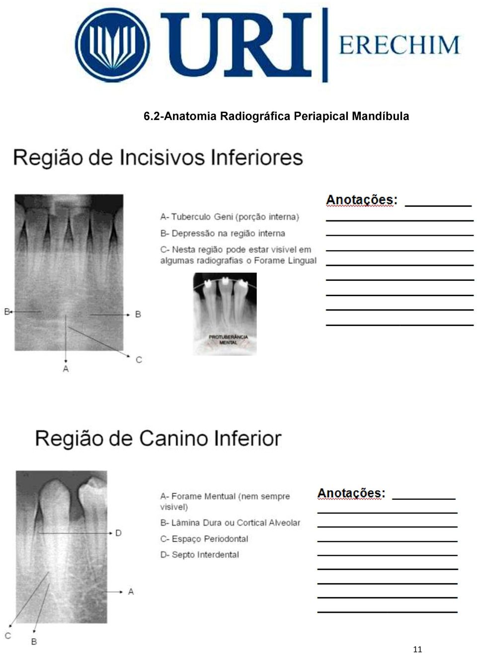 Periapical