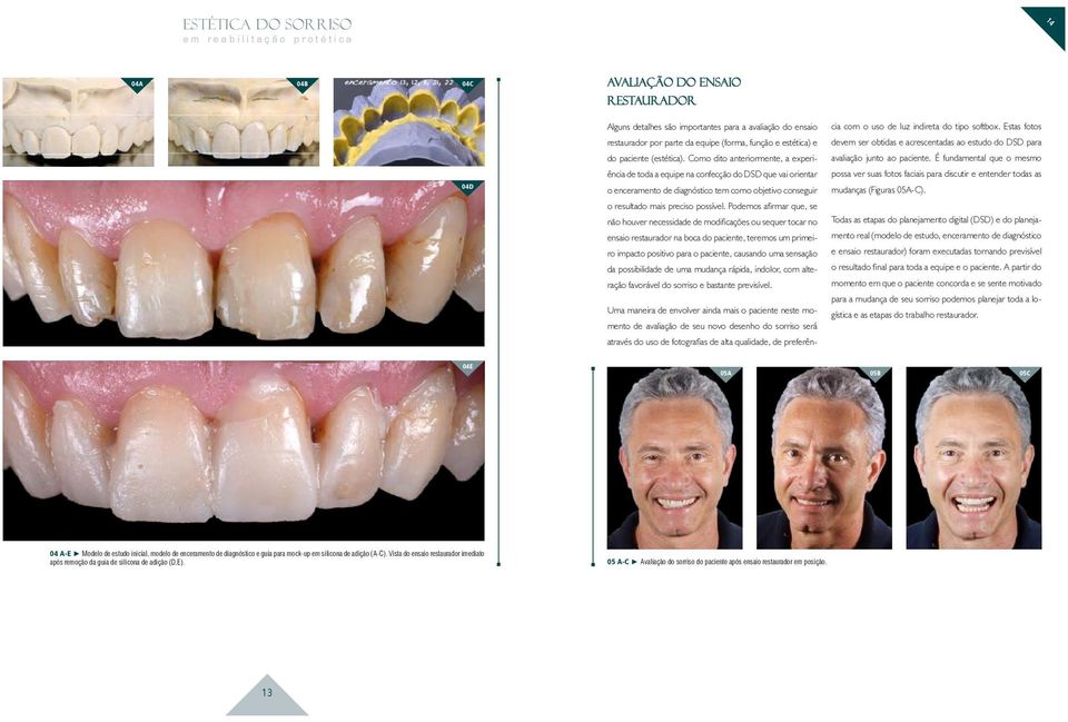 um primeiro impacto positivo para o paciente, causando uma sensação da possibilidade de uma mudança rápida, indolor, com alteração favorável do sorriso e bastante previsível.