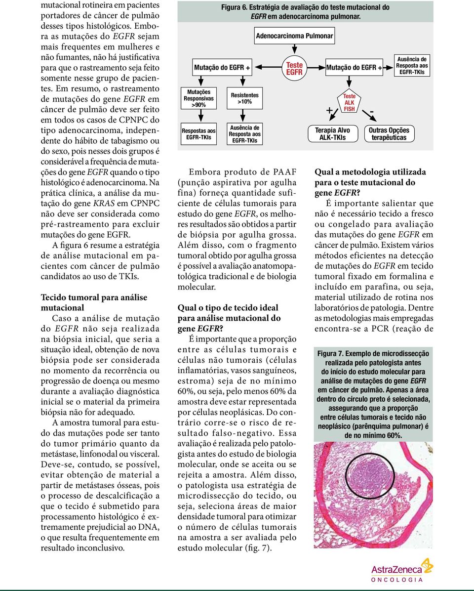 Em resumo, o rastreamento de mutações do gene EGFR em câncer de pulmão deve ser feito em todos os casos de CPNPC do tipo adenocarcinoma, independente do hábito de tabagismo ou do sexo, pois nesses