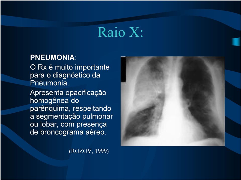 Apresenta opacificação homogênea do parênquima,