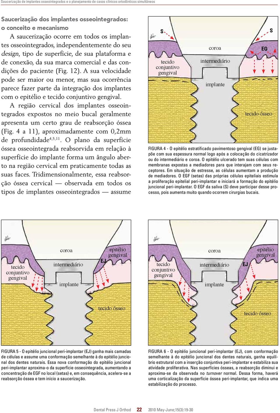 A sua velocidade pode ser maior ou menor, mas sua ocorrência parece fazer parte da integração dos s com o epitélio e tecido conjuntivo gengival.