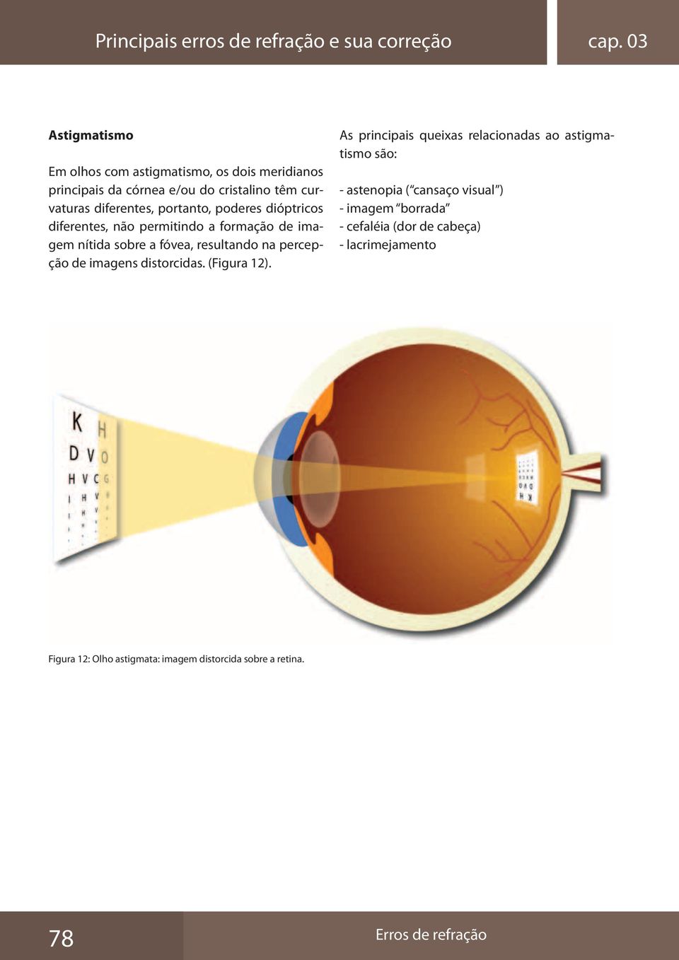 portanto, poderes dióptricos diferentes, não permitindo a formação de imagem nítida sobre a fóvea, resultando na percepção de imagens