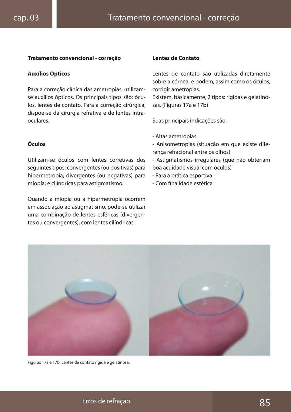 Óculos Utilizam-se óculos com lentes corretivas dos seguintes tipos: convergentes (ou positivas) para hipermetropia; divergentes (ou negativas) para miopia; e cilíndricas para astigmatismo.