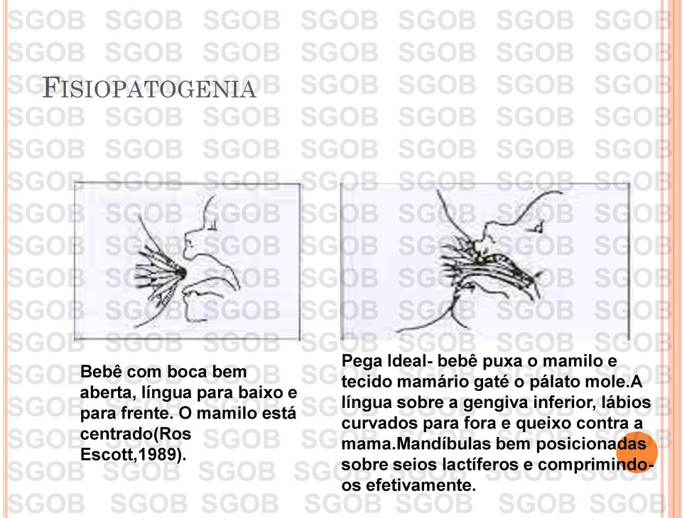 Pega Ideal- bebê puxa o mamilo e tecido mamário gaté o pálato mole.