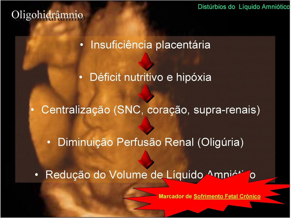 supra-renais) Diminuição Perfusão Renal (Oligúria)