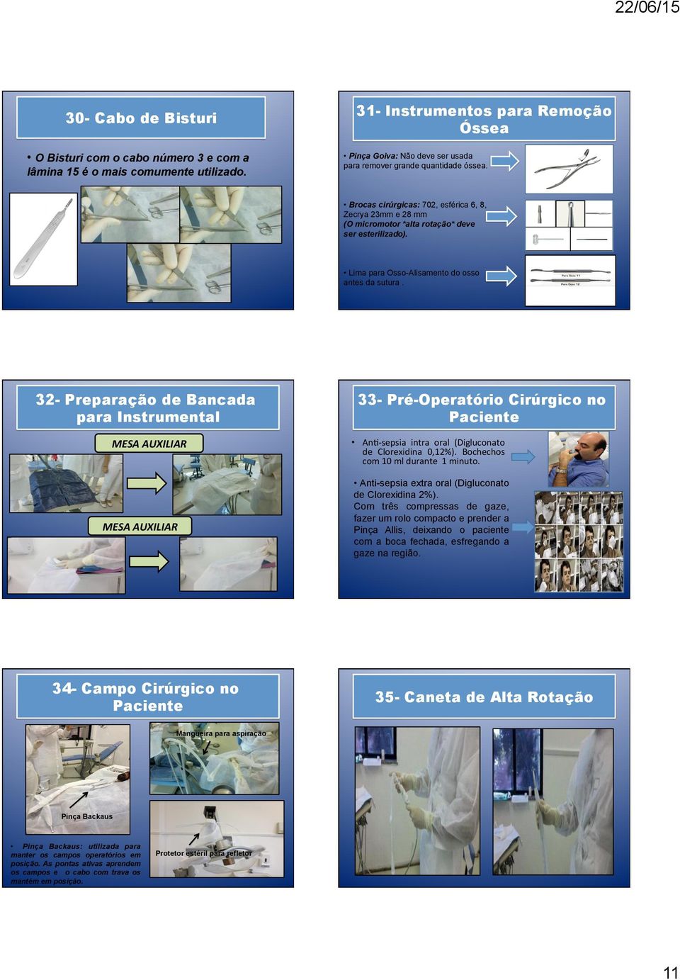 Brocas cirúrgicas: 702, esférica 6, 8, Zecrya 23mm e 28 mm (O micromotor *alta rotação* deve ser esterilizado). Lima para Osso-Alisamento do osso antes da sutura.