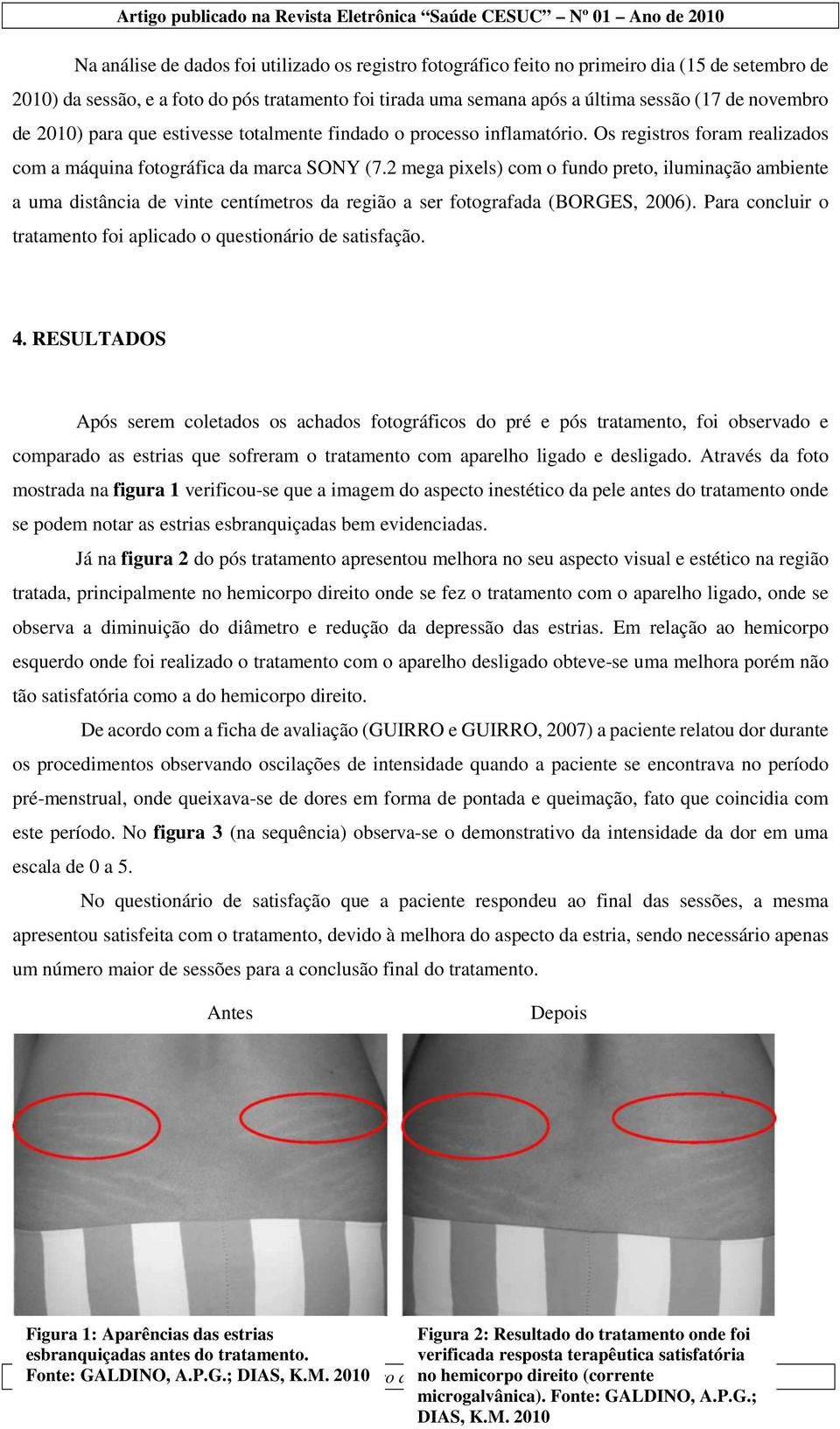 2 mega pixels) com o fundo preto, iluminação ambiente a uma distância de vinte centímetros da região a ser fotografada (BORGES, 2006).