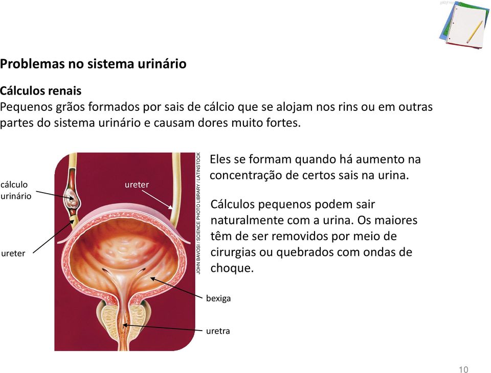 cálculo urinário ureter ureter JOHN BAVOSI / SCIENCE PHOTO LIBRARY / LATINSTOCK Eles se formam quando há aumento na