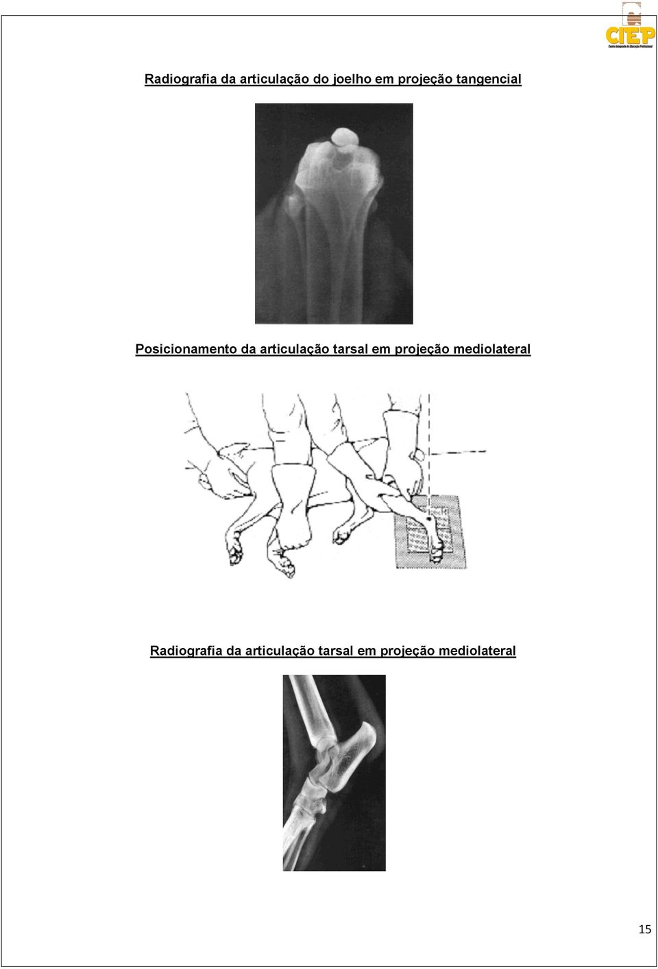 articulação tarsal em projeção mediolateral