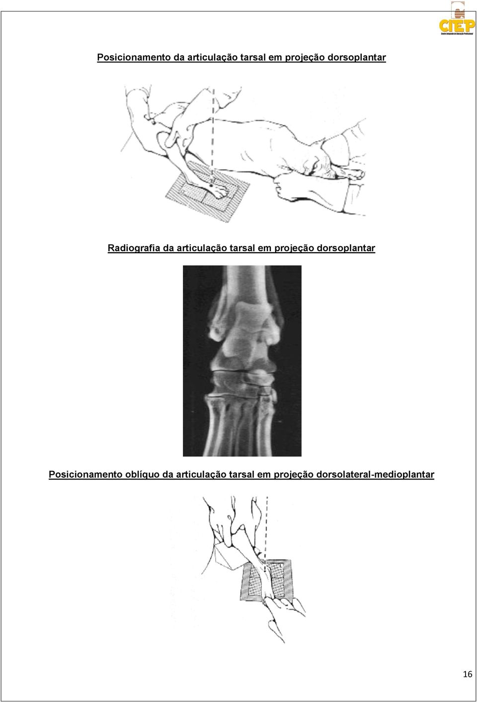 projeção dorsoplantar Posicionamento oblíquo da