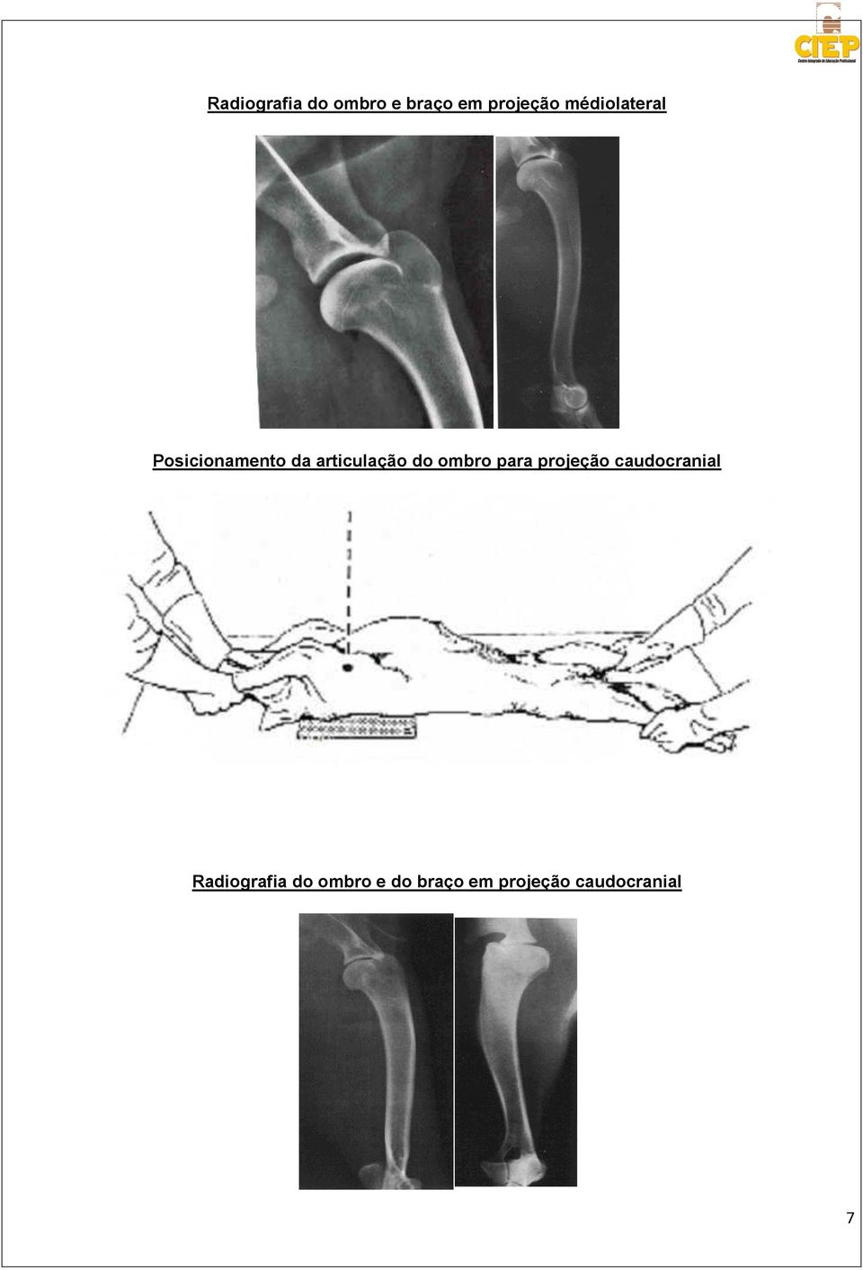 do ombro para projeção caudocranial